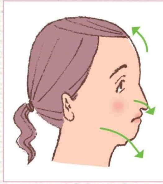 口呼吸を続けた場合の下方成長イラスト