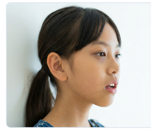 下方成長（口呼吸）の女の子の横顔